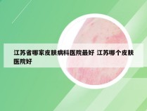 江苏省哪家皮肤病科医院最好 江苏哪个皮肤医院好