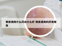 银屑病用什么药水什么好 银屑病用的药有哪些