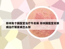 郑州有个国医堂治疗牛皮癣 郑州国医堂皮肤病治疗银屑病怎么样