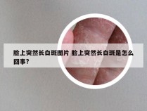 脸上突然长白斑图片 脸上突然长白斑是怎么回事?