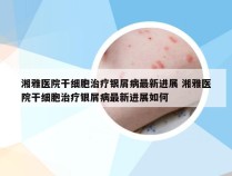 湘雅医院干细胞治疗银屑病最新进展 湘雅医院干细胞治疗银屑病最新进展如何