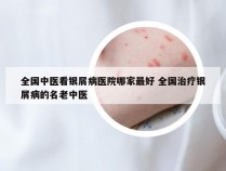 全国中医看银屑病医院哪家最好 全国治疗银屑病的名老中医