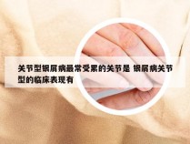 关节型银屑病最常受累的关节是 银屑病关节型的临床表现有