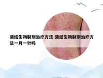 溃结生物制剂治疗方法 溃结生物制剂治疗方法一月一针吗