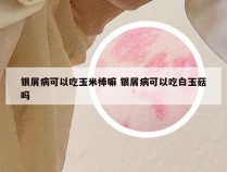 银屑病可以吃玉米棒嘛 银屑病可以吃白玉菇吗