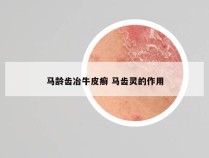马龄齿冶牛皮癣 马齿灵的作用