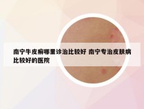 南宁牛皮癣哪里诊治比较好 南宁专治皮肤病比较好的医院