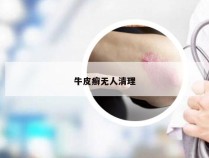 牛皮癣无人清理
