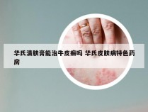 华氏清肤膏能治牛皮癣吗 华氏皮肤病特色药房