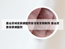 唐山京城皮肤病医院有没有生物制剂 唐山京唐皮肤病医院