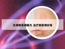 无锡银屑病偏方 治疗银屑病价格