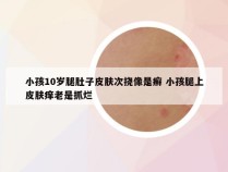小孩10岁腿肚子皮肤次挠像是癣 小孩腿上皮肤痒老是抓烂