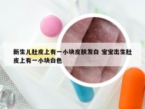 新生儿肚皮上有一小块皮肤发白 宝宝出生肚皮上有一小块白色