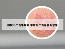 楼房小广告牛皮癣 牛皮癣广告是什么意思