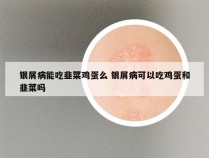 银屑病能吃韭菜鸡蛋么 银屑病可以吃鸡蛋和韭菜吗