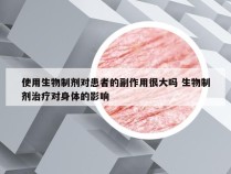 使用生物制剂对患者的副作用很大吗 生物制剂治疗对身体的影响