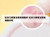 在浙江那里治银屑病最好 在浙江那里治银屑病最好呢