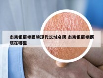 南京银屑病医院现代长城名医 南京银屑病医院在哪里