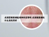 点滴型银屑病能用神农百草吗 点滴银屑病吃什么消炎药好