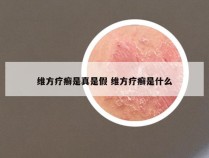 维方疗癣是真是假 维方疗癣是什么