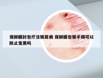 保鲜膜封包疗法银屑病 保鲜膜包银手镯可以防止变黑吗