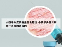 小孩子头皮长癣是什么原因 小孩子头皮长癣是什么原因造成的