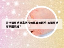 治疗银屑病那家医院效果好的医院 治银屑病哪家医院好?