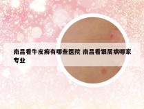南昌看牛皮癣有哪些医院 南昌看银屑病哪家专业