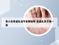 有人吃肖遥丸治牛皮癣贴吧 肖遥丸多少钱一盒