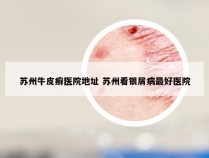 苏州牛皮癣医院地址 苏州看银屑病最好医院