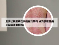 点滴状银屑病吃头孢有效果吗 点滴状银屑病可以输液治疗吗?
