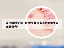 生物制剂拓咨打针疼吗 拓咨生物制剂明年会进医保吗?