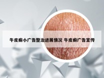 牛皮癣小广告整治进展情况 牛皮癣广告宣传