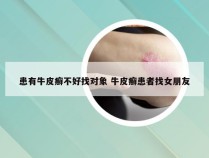患有牛皮癣不好找对象 牛皮癣患者找女朋友