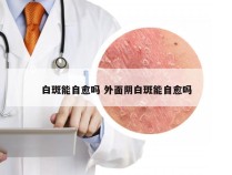 白斑能自愈吗 外面阴白斑能自愈吗