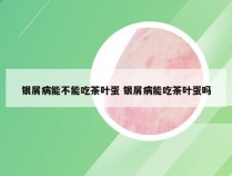银屑病能不能吃茶叶蛋 银屑病能吃茶叶蛋吗