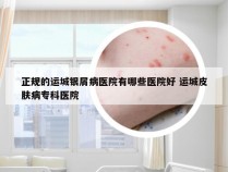 正规的运城银屑病医院有哪些医院好 运城皮肤病专科医院