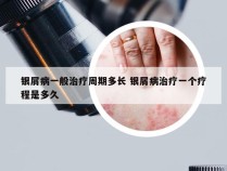 银屑病一般治疗周期多长 银屑病治疗一个疗程是多久