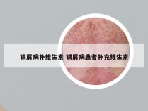 银屑病补维生素 银屑病患者补充维生素