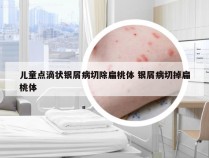 儿童点滴状银屑病切除扁桃体 银屑病切掉扁桃体