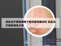 南昌治疗银屑病哪个医院服务最好的 南昌治疗银屑病多少钱