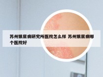 苏州银屑病研究所医院怎么样 苏州银屑病哪个医院好