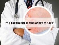 疗廯卡西甫丸的作用 疗癣卡西甫丸怎么吃法