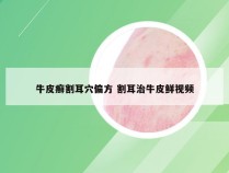 牛皮癣割耳穴偏方 割耳治牛皮鲜视频