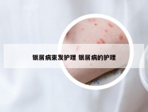 银屑病束发护理 银屑病的护理