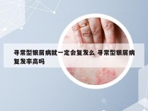 寻常型银屑病就一定会复发么 寻常型银屑病复发率高吗