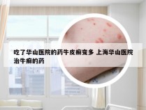 吃了华山医院的药牛皮癣变多 上海华山医院治牛癣的药