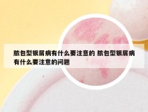 脓包型银屑病有什么要注意的 脓包型银屑病有什么要注意的问题