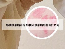 韩国银屑病治疗 韩国治银屑病的都有什么药