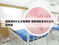 银屑病为什么不能喝茶 银屑病患者为什么不能喝酒